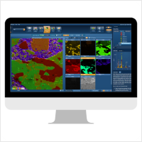 AZtec Live Lite con AZtec Feature